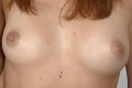 Tits of Nadia