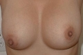 Tits of Alison
